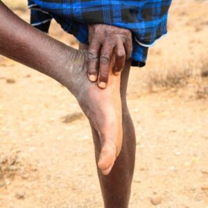 Community Health Workers share experiences addressing snakebites in Kajiado, Kenya